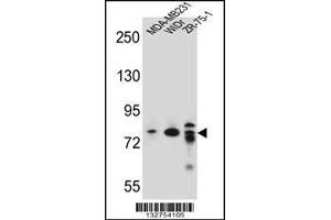 Western blot analysis in MDA-MB231,WiDr,ZR-75-1 cell line lysates (35ug/lane). (ARHGAP22 抗体  (C-Term))