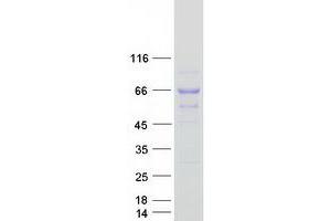 Western Blotting (WB) image for Nucleoporin 62kDa (NUP62) (Transcript Variant 2) protein (Myc-DYKDDDDK Tag) (ABIN2727825)