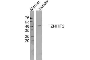Mouse bladder lysates probed with ZNHIT2 Polyclonal Antibody, Unconjugated  at 1:300 dilution and 4˚C overnight incubation. (ZNHIT2 抗体  (AA 51-150))