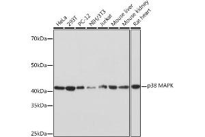 Western blot analysis of extracts of various cell lines, using p38 MAPK Rabbit mAb (ABIN1682699, ABIN3019202, ABIN3019203 and ABIN7101731) at 1:1000 dilution. (MAPK14 抗体)