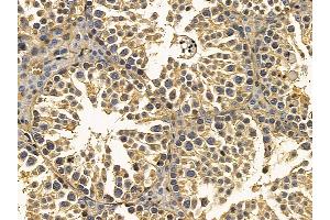 pan Actin Mouse Monoclonal Antibody at 1/100 staining mouse testis tissue by IHC-P. (Actin 抗体  (pan))