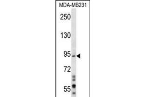 D1L1 Antibody (N-term) (ABIN656281 and ABIN2845591) western blot analysis in MDA-M cell line lysates (35 μg/lane). (MAD1L1 抗体  (N-Term))