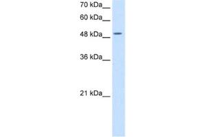 Western Blotting (WB) image for anti-Eukaryotic Translation Initiation Factor 2, Subunit 3 Gamma, 52kDa (EIF2S3) antibody (ABIN2462926) (EIF2S3 抗体)