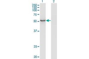 Western Blot analysis of ZNF70 expression in transfected 293T cell line by ZNF70 monoclonal antibody (M01), clone 1D8. (ZNF70 抗体  (AA 1-446))