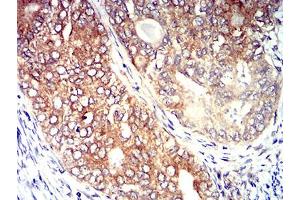Immunohistochemistry (IHC) image for anti-Chemokine (C-C Motif) Receptor 5 (CCR5) antibody (ABIN5611203)