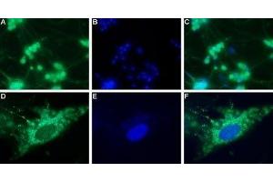 Expression of neuropeptide Y4 receptor in rat DRG - Immunocytochemical staining of a primary culture of rat dorsal root ganglion (DRG) neurons. (NPY4R 抗体  (C-Term, Intracellular))