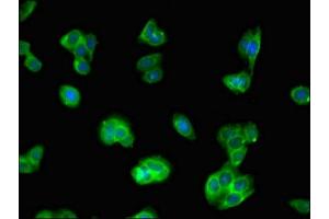 Immunofluorescent analysis of HepG2 cells using ABIN7157038 at dilution of 1:100 and Alexa Fluor 488-congugated AffiniPure Goat Anti-Rabbit IgG(H+L) (IQCG 抗体  (AA 1-134))
