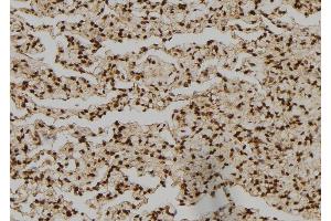 ABIN6276450 at 1/100 staining Human lung tissue by IHC-P. (NCK1 抗体  (Internal Region))