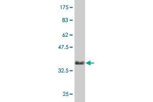 Western Blot detection against Immunogen (35. (AKT2 抗体  (AA 100-189))