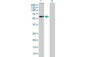 Western Blot analysis of ABCC11 expression in transfected 293T cell line by ABCC11 MaxPab polyclonal antibody. (ABCC11 抗体  (AA 1-553))