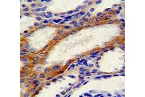 STIM1 antibody immunohistochemistry analysis in formalin fixed and paraffin embedded human kidney tissue. (STIM1 抗体  (AA 509-538))