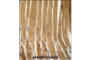 CASP5 Antibody (Center) (ABIN654898 and ABIN2844547) immunohistochemistry analysis in formalin fixed and paraffin embedded human skeletal muscle followed by peroxidase conjugation of the secondary antibody and DAB staining. (CASP5 抗体  (AA 162-191))