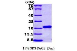 SDS-PAGE (SDS) image for Nuclear Cap Binding Protein Subunit 2 (NCBP2) (AA 1-156) protein (His tag) (ABIN667237) (NCBP2 Protein (AA 1-156) (His tag))