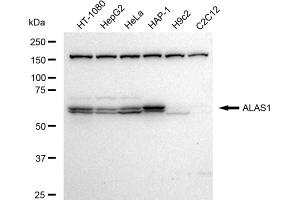anti-Aminolevulinate, delta-, Synthase 1 (ALAS1) antibody