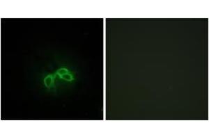 Immunofluorescence analysis of NIH-3T3 cells, using BLCAP Antibody. (BLCAP 抗体  (AA 38-87))