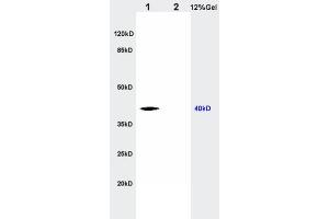 L1 rat kidney lysates L2 rat brain lysates probed with Anti CTHRC1 Polyclonal Antibody, Unconjugated  at 1:200 in 4˚C. (CTHRC1 抗体  (AA 31-130))