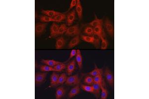 Immunofluorescence (IF) image for anti-Obg-Like ATPase 1 (OLA1) (AA 297-396) antibody (ABIN6145010)