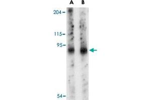 Western blot analysis of SLITRK6 in mouse lung tissue lysate with SLITRK6 polyclonal antibody  at (A) 0. (SLITRK6 抗体  (Internal Region))