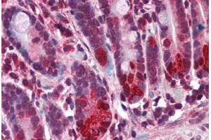 Human Small Intestine (formalin-fixed, paraffin-embedded) stained with NOD2 antibody ABIN351443 at 3 ug/ml followed by biotinylated goat anti-rabbit IgG secondary antibody ABIN481713, alkaline phosphatase-streptavidin and chromogen. (NOD2 抗体  (N-Term))