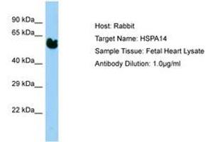 Image no. 1 for anti-Heat Shock 70kDa Protein 14 (HSPA14) (AA 37-86) antibody (ABIN6750192) (HSPA14 抗体  (AA 37-86))