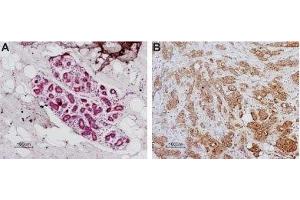 Immunohistochemistry (IHC) image for anti-Coagulation Factor II (thrombin) Receptor (F2R) (AA 61-76), (Extracellular) antibody (ABIN7043073)