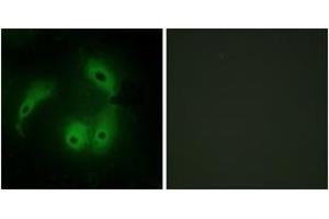 Immunofluorescence analysis of HeLa cells, using AKAP14 Antibody. (AKAP14 抗体  (AA 1-50))