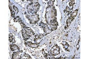 IHC analysis of Ki67/MKI67 using anti-Ki67/MKI67 antibody (ABIN7601873). (Ki-67 抗体  (AA 5-2358))