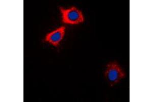 Immunofluorescent analysis of CaMK2 alpha/delta staining in HEK293A cells. (CaMK2 alpha/delta 抗体  (Center))