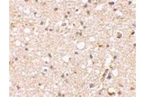 Immunohistochemical staining of human brain tissue using AP30381PU-N Grik1 antibody at 2. (GRIK1 抗体  (Center))