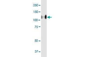 CEACAM1 MaxPab polyclonal antibody. (CEACAM1 抗体  (AA 1-464))