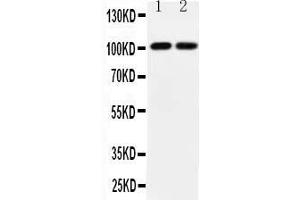 Anti-GRIA3 antibody, All Western blottingAll lanes: Anti-GRIA3  at 0. (Glutamate Receptor 3 抗体  (Middle Region))
