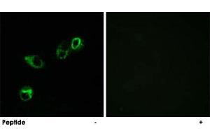 Immunofluorescence analysis of MCF-7 cells, using CCRL1 polyclonal antibody . (CCRL1 抗体  (C-Term))