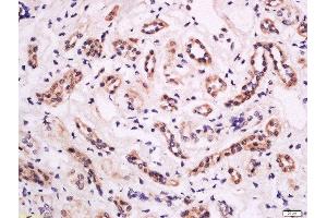Formalin-fixed and paraffin embedded human kidney tissue labeled with Anti-CD18 (Thr758) Polyclonal Antibody, Unconjugated  at 1:200 followed by conjugation to the secondary antibody and DAB staining. (Integrin beta 2 抗体  (pThr758))