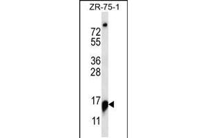 Western blot analysis in ZR-75-1 cell line lysates (35ug/lane). (RPP25 抗体  (C-Term))