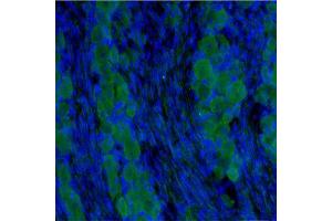 Immunofluorescence (IF) image for anti-Neurotrophic tyrosine Kinase, Receptor, Type 3 (NTRK3) (Extracellular Domain) antibody (ABIN351085)