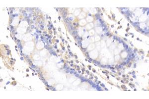 Detection of Slit2 in Human Colon Tissue using Polyclonal Antibody to Slit Homolog 2 (Slit2) (SLIT2 抗体  (AA 664-777))