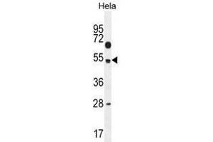TSPYL6 Antibody (Center) western blot analysis in Hela cell line lysates (35 µg/lane). (TSPY-Like 6 抗体  (Middle Region))