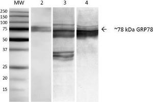 Western Blot analysis of Human, Mouse, Rat NIH3T3, Rat Brain, and HEK-293 cell lysates showing detection of ~78 kDa GRP78 protein using Mouse Anti-GRP78 Monoclonal Antibody, Clone 3C5-1A4 . (GRP78 抗体)