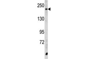 Western blot analysis of CPD antibody and HeLa lysate. (CPD 抗体  (AA 1019-1048))