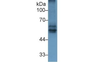 Detection of BACE2 in Rat Spleen lysate using Polyclonal Antibody to Beta Secretase 2 (BACE2) (BACE2 抗体  (AA 242-502))