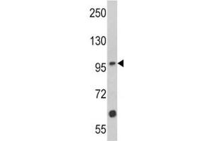 Western blot analysis of MUSK antibody and Jurkat lysate