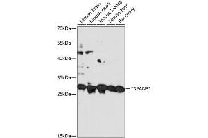 Western blot analysis of extracts of various cell lines, using TSP antibody (ABIN7270789) at 1:3000 dilution. (TSPAN31 抗体  (AA 95-175))