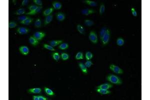 Immunofluorescent analysis of HepG2 cells using ABIN7174852 at dilution of 1:100 and Alexa Fluor 488-congugated AffiniPure Goat Anti-Rabbit IgG(H+L) (C4ORF3 抗体  (AA 1-44))