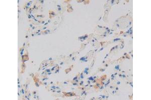 Used in DAB staining on fromalin fixed paraffin- embedded Kidney tissue