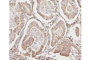 IHC analysis of CALR using anti-CALR antibody (ABIN7600329). (Calreticulin 抗体  (AA 18-323))