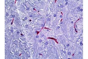 Anti-RECA-1 antibody IHC of rat brain, cerebellum vessels. (RECA-1 抗体)