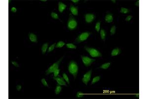 Immunofluorescence (IF) image for anti-ATPase, Ca++ Transporting, Type 2C, Member 1 (ATP2C1) (AA 119-269) antibody (ABIN565309)
