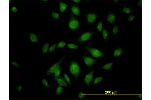 Immunofluorescence of monoclonal antibody to ATP2C1 on HeLa cell. (ATP2C1 抗体  (AA 119-269))