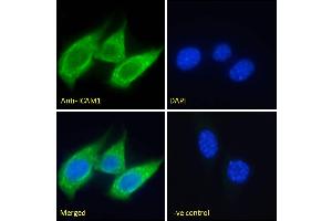 ABIN5539625 Immunofluorescence analysis of paraformaldehyde fixed NIH3T3 cells, permeabilized with 0. (ICAM1 抗体  (Internal Region))
