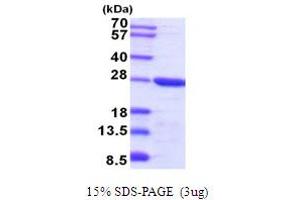 SDS-PAGE (SDS) image for Tumor Protein, Translationally-Controlled 1 (TPT1) (AA 1-172) protein (His tag) (ABIN5854238) (TPT1 Protein (AA 1-172) (His tag))